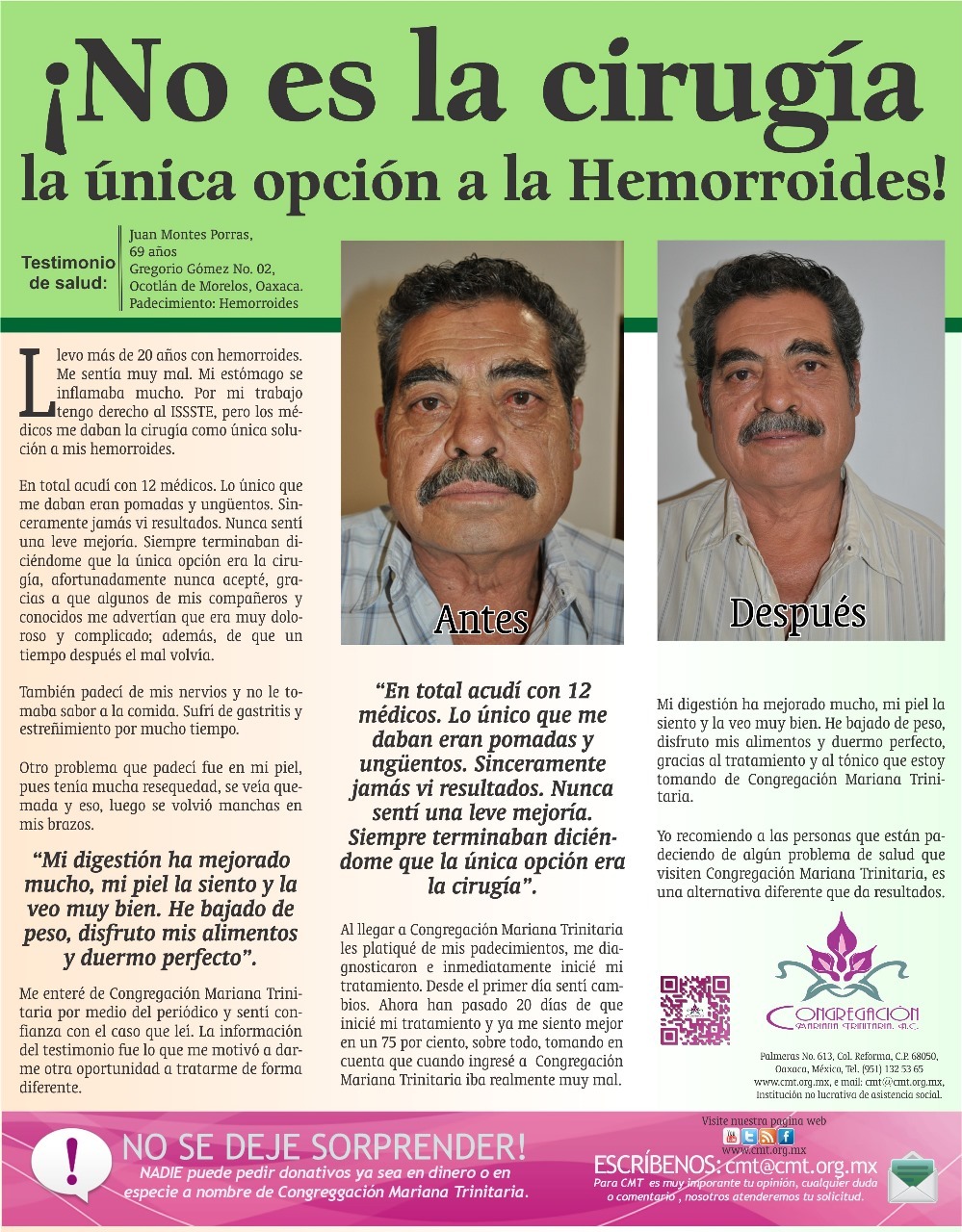 Prensa: NO ES LA CIRUGÍA LA ÚNICA OPCIÓN A LA HEMORROIDES